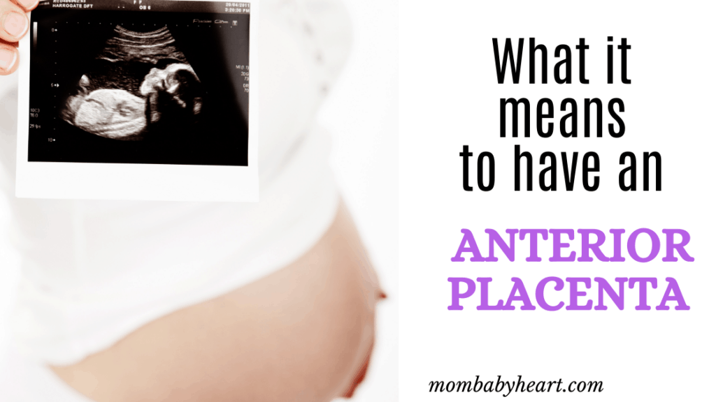 Featured Image of anterior placenta